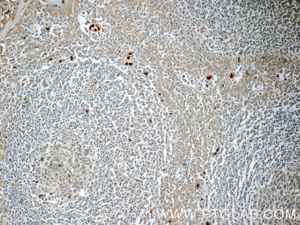 Immunohistochemistry (IHC) staining of human tonsillitis tissue using LY6G5B Polyclonal antibody (24611-1-AP)