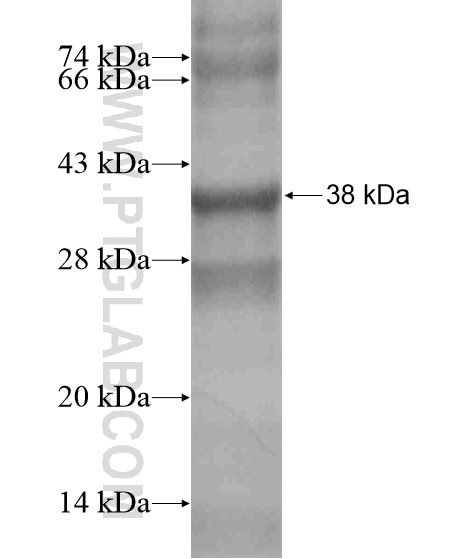 LY6G5C fusion protein Ag18812 SDS-PAGE