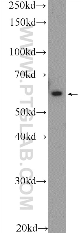 Western Blot (WB) analysis of HL-60 cells using LY6G6F Polyclonal antibody (25872-1-AP)