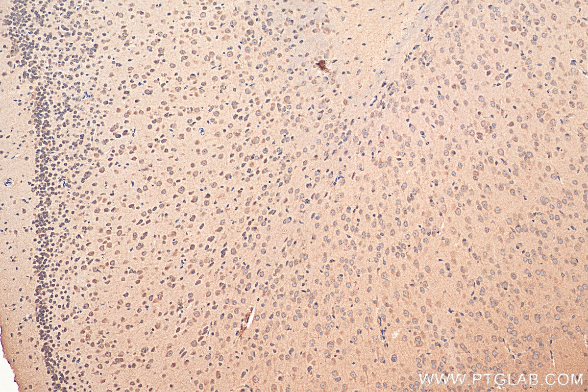 Immunohistochemistry (IHC) staining of mouse brain tissue using LY6H Polyclonal antibody (23933-1-AP)