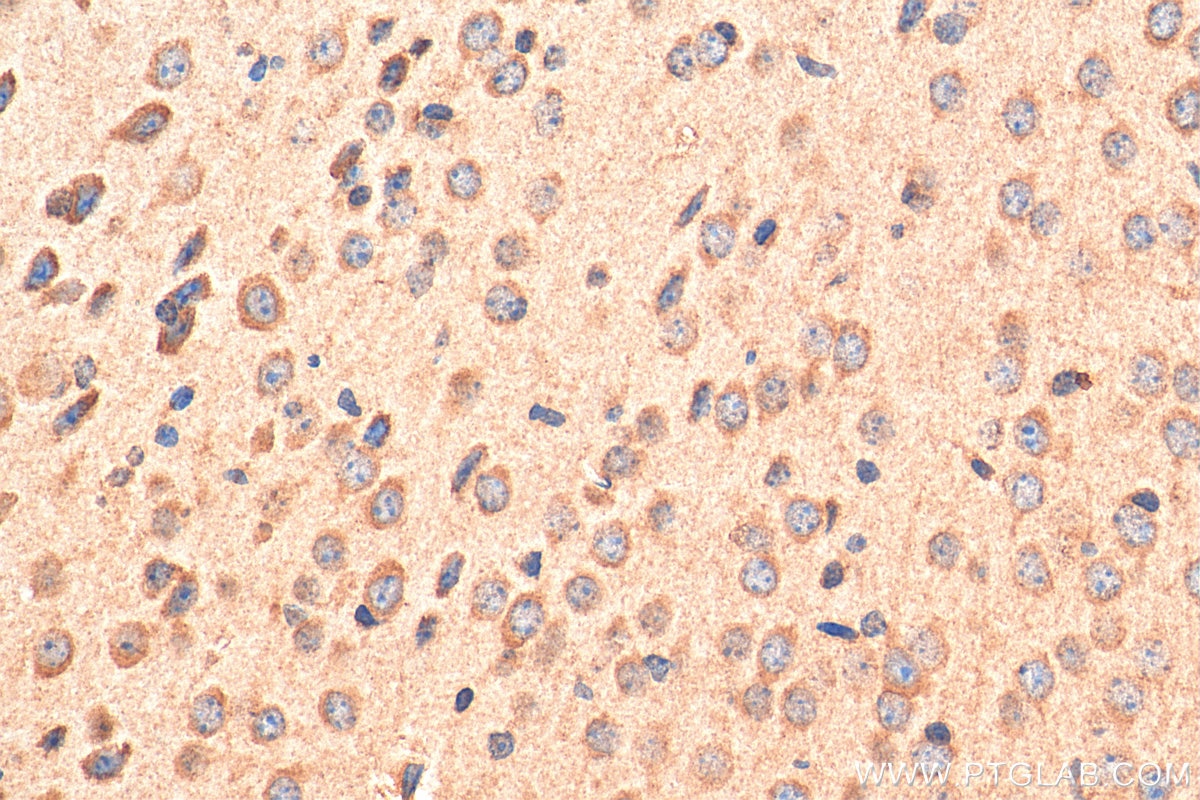 Immunohistochemistry (IHC) staining of mouse brain tissue using LY6H Polyclonal antibody (23933-1-AP)