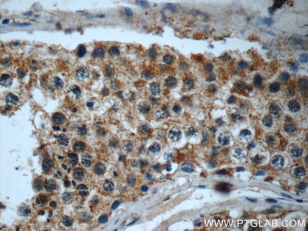 Immunohistochemistry (IHC) staining of human testis tissue using LY6H Polyclonal antibody (23933-1-AP)