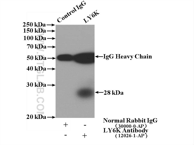 Immunoprecipitation (IP) experiment of PC-3 cells using LY6K Polyclonal antibody (12026-1-AP)