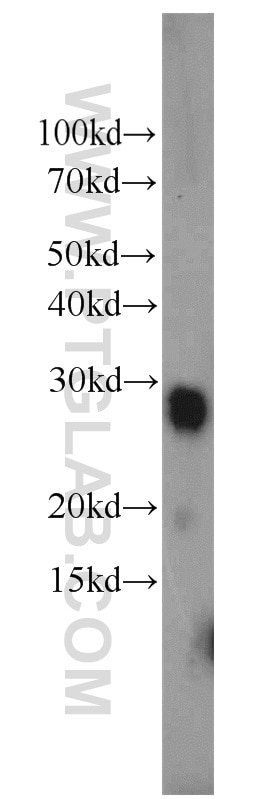 Western Blot (WB) analysis of human testis tissue using LY6K Polyclonal antibody (12026-1-AP)