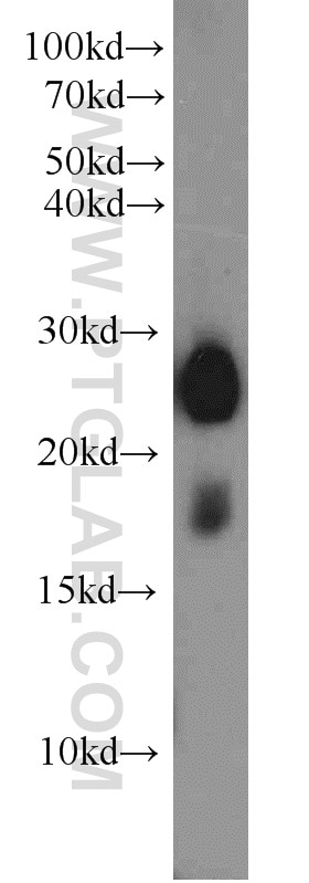 Western Blot (WB) analysis of human testis tissue using LY6K Polyclonal antibody (12026-1-AP)