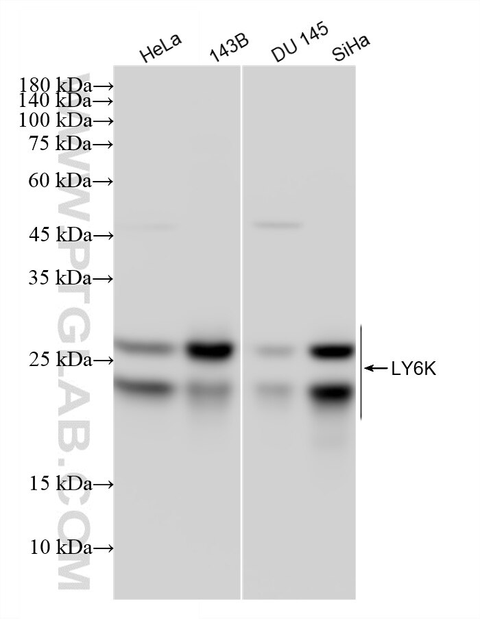 WB analysis using 87480-1-RR (same clone as 87480-1-PBS) Western Blot (WB) analysis of various lysates using LY6K Recombinant monoclonal antibody (87480-1-RR)