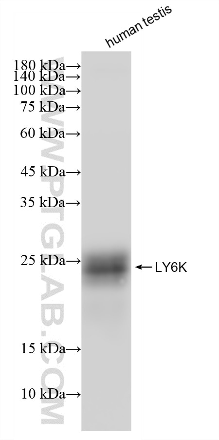 WB analysis using 87480-1-RR (same clone as 87480-1-PBS) Western Blot (WB) analysis of various lysates using LY6K Recombinant monoclonal antibody (87480-1-RR)