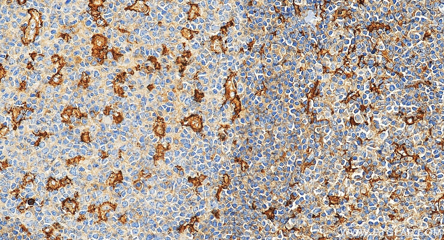 Immunohistochemical analysis of paraffin-embedded human tonsillitis tissue slide using 32754-1-AP (LY75/DEC-205 antibody) at dilution of 1:500 (under 20x lens). Heat mediated antigen retrieval with Tris-EDTA buffer (pH 9.0). Immunohistochemistry (IHC) staining of human tonsillitis tissue using LY75/DEC-205 Polyclonal antibody (32754-1-AP)
