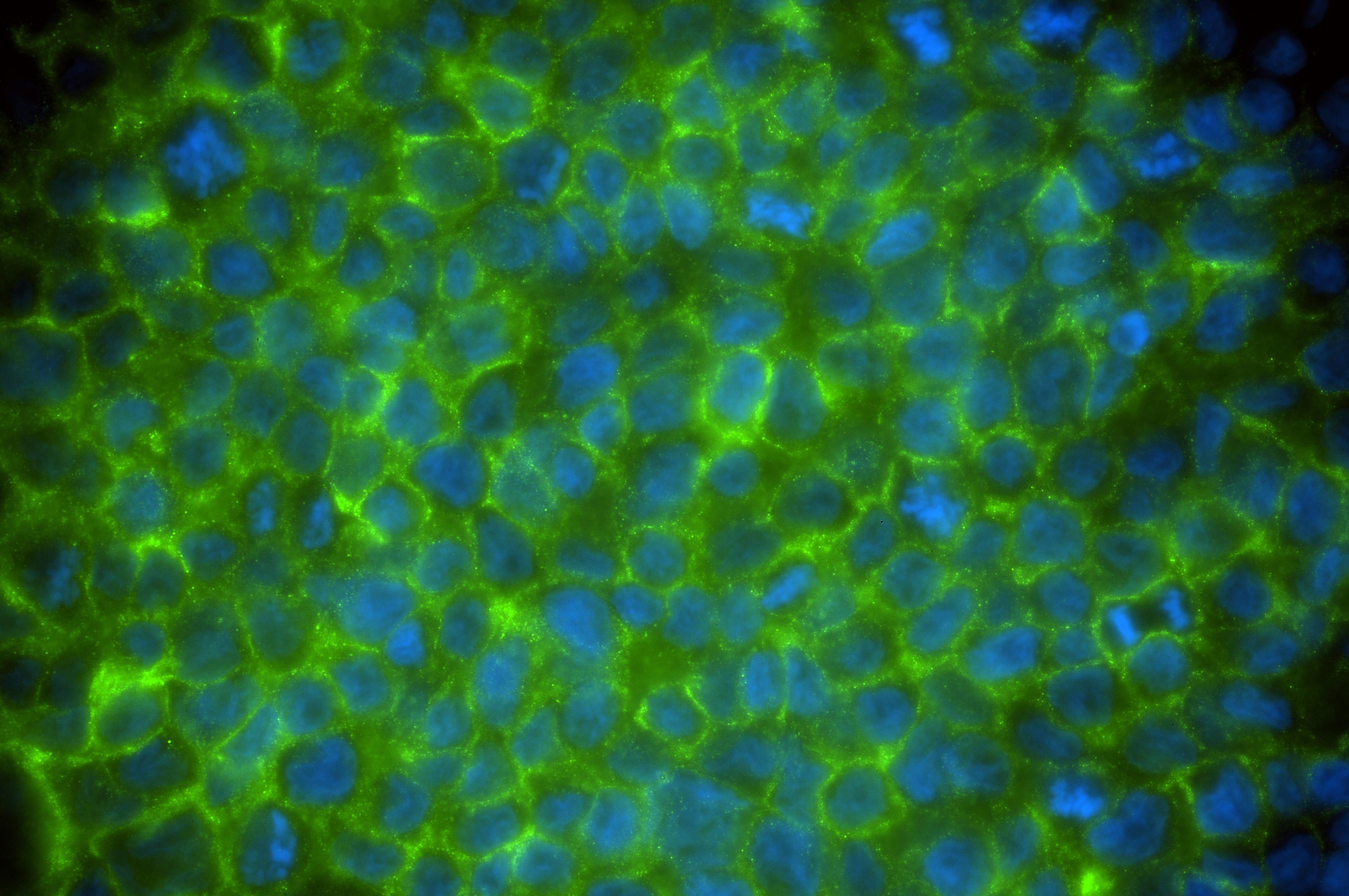 Immunofluorescence (IF) / fluorescent staining of THP-1 cells using LY86 Recombinant monoclonal antibody (87173-1-RR)