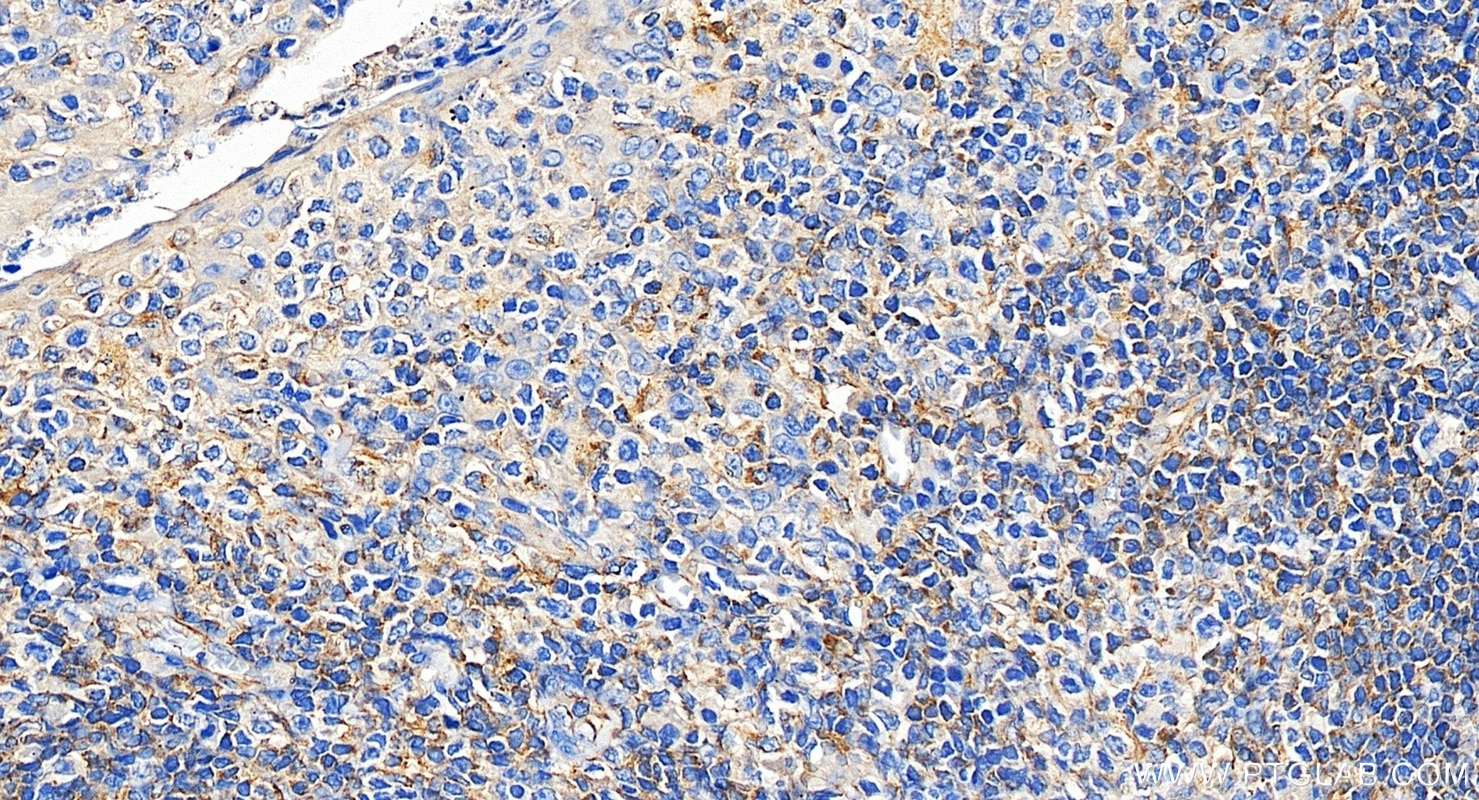 Immunohistochemistry (IHC) staining of human tonsillitis tissue using LY86 Recombinant monoclonal antibody (87173-1-RR)