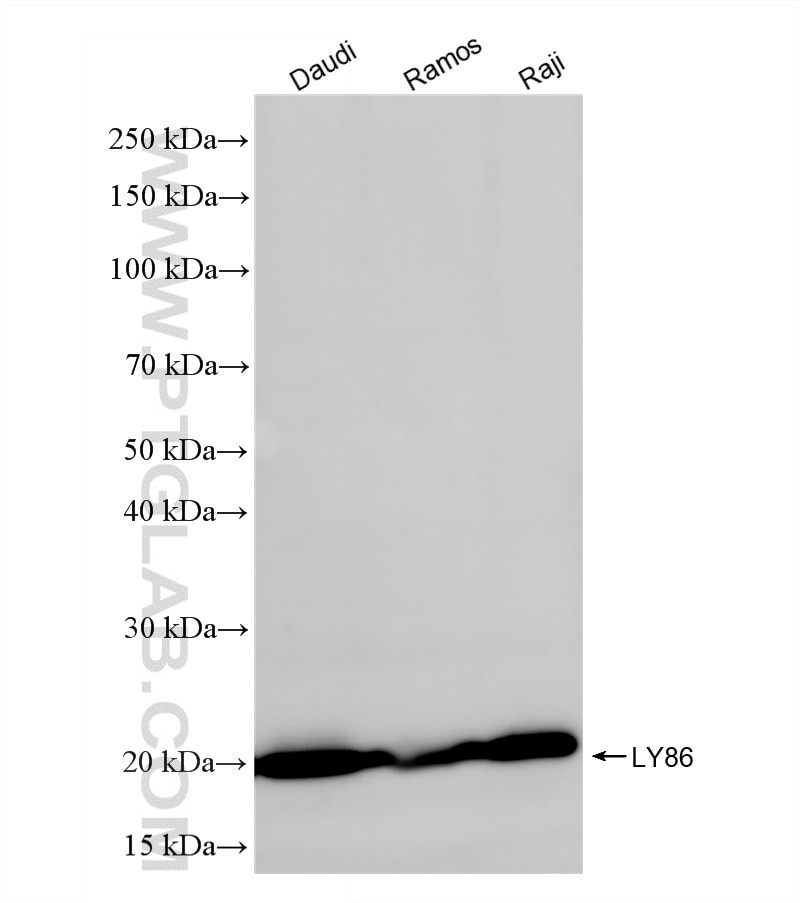 Western Blot (WB) analysis of various lysates using LY86 Recombinant monoclonal antibody (87173-1-RR)