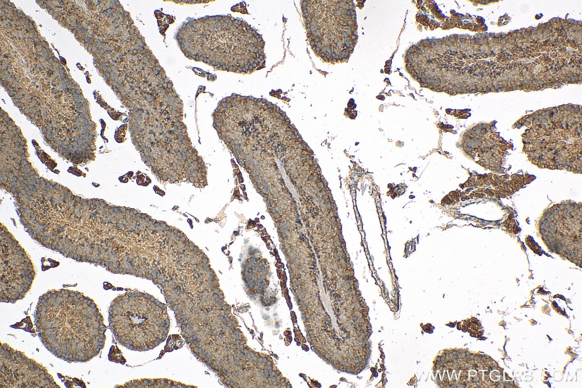 Immunohistochemistry (IHC) staining of mouse testis tissue using LY96/MD2 Polyclonal antibody (11784-1-AP)