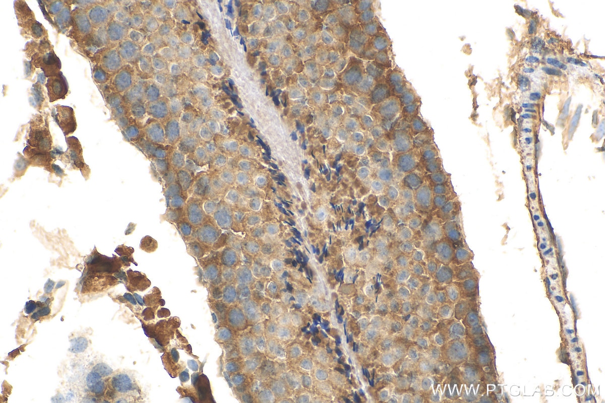 Immunohistochemistry (IHC) staining of mouse testis tissue using LY96/MD2 Polyclonal antibody (11784-1-AP)