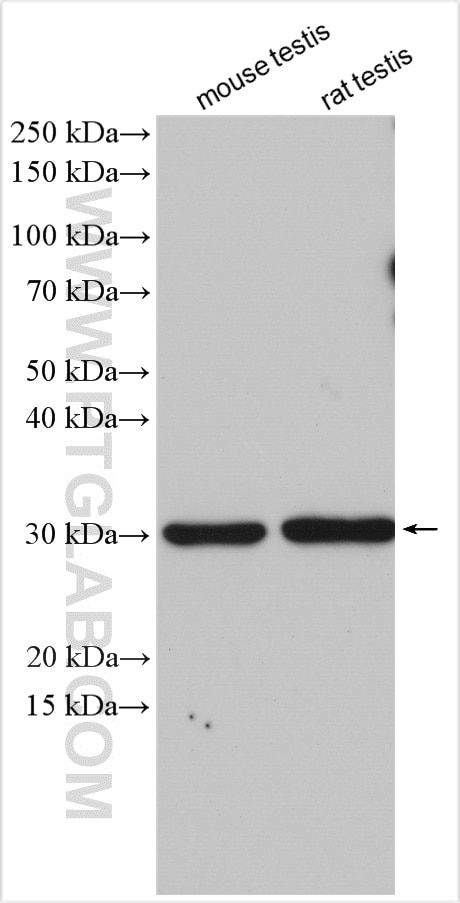 Western Blot (WB) analysis of various lysates using LY96/MD2 Polyclonal antibody (11784-1-AP)