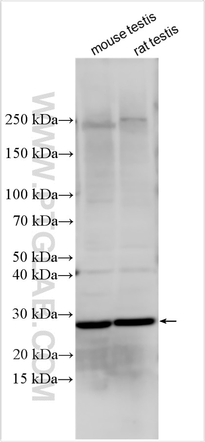Western Blot (WB) analysis of various lysates using LY96/MD2 Polyclonal antibody (11784-1-AP)