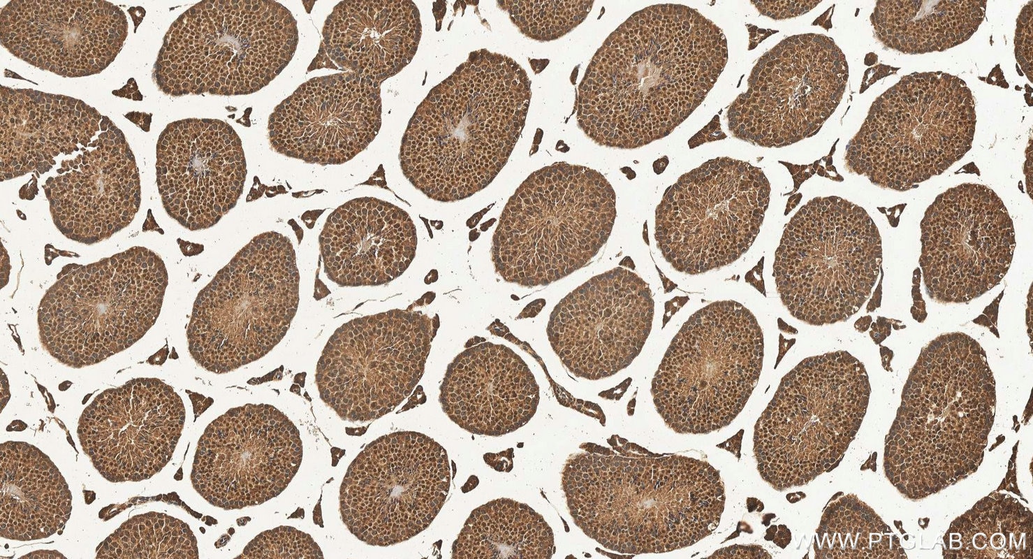 Immunohistochemistry (IHC) staining of mouse testis tissue using LYAR Polyclonal antibody (24433-1-AP)