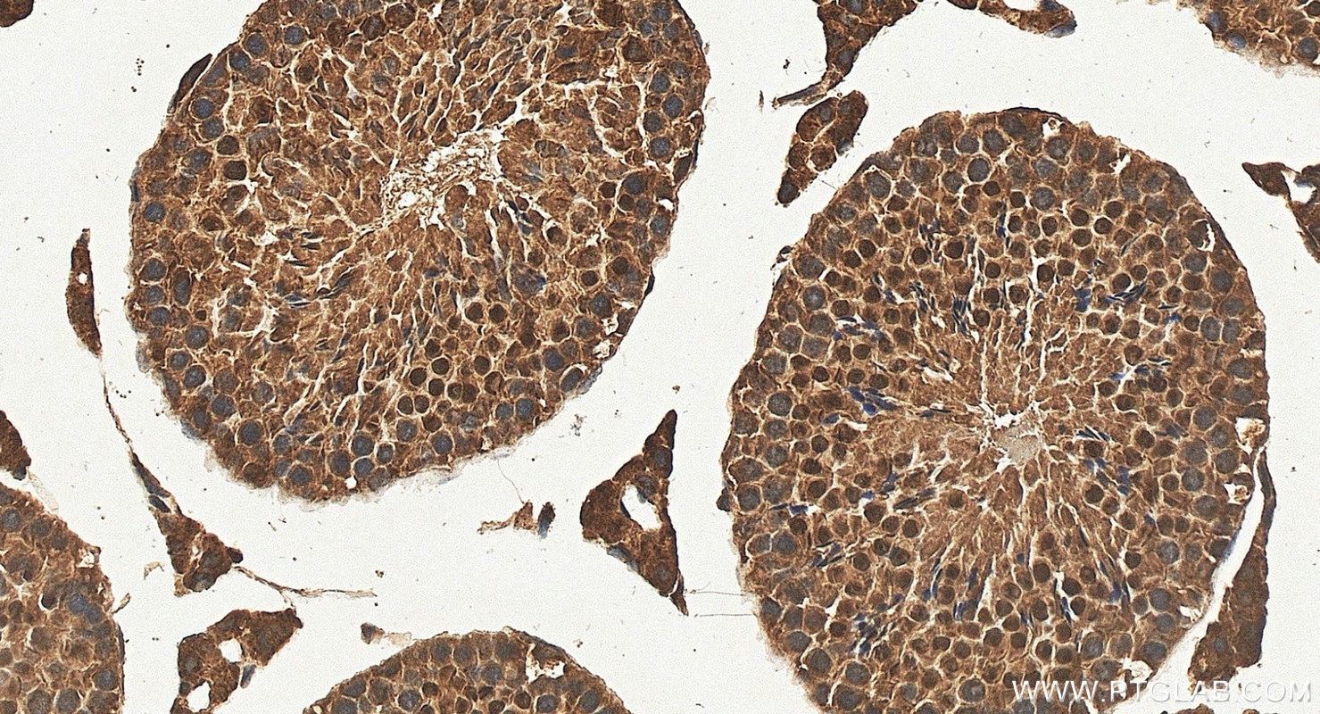 Immunohistochemistry (IHC) staining of mouse testis tissue using LYAR Polyclonal antibody (24433-1-AP)