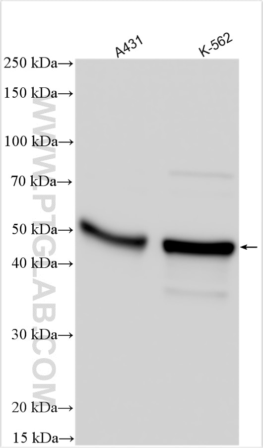 Western Blot (WB) analysis of various lysates using LYAR Polyclonal antibody (24433-1-AP)