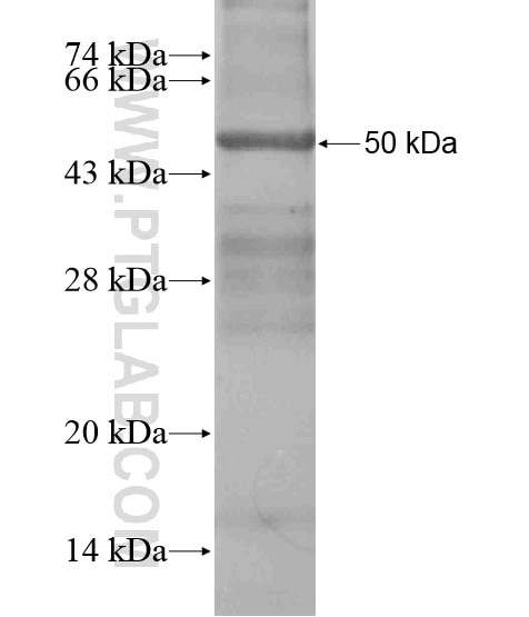 LYAR fusion protein Ag19599 SDS-PAGE