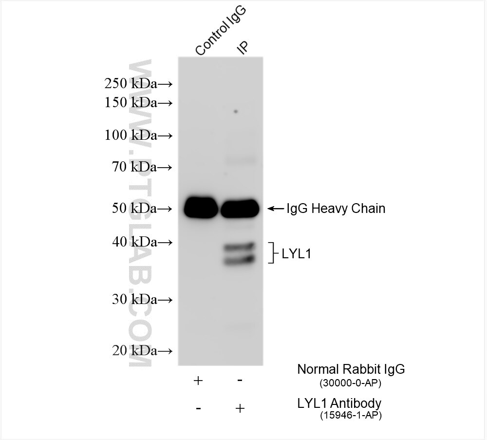 Immunoprecipitation (IP) experiment of K-562 cells using LYL1 Polyclonal antibody (15946-1-AP)