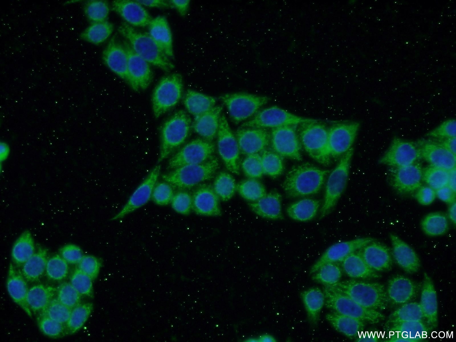 Immunofluorescence (IF) / fluorescent staining of HeLa cells using LYN Polyclonal antibody (18135-1-AP)