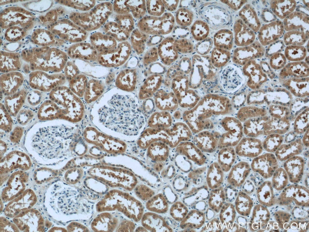 Immunohistochemistry (IHC) staining of human kidney tissue using LYN Polyclonal antibody (18135-1-AP)