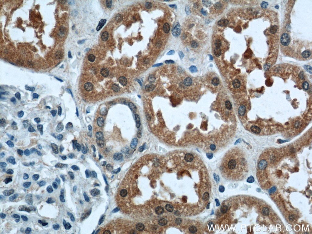 Immunohistochemistry (IHC) staining of human kidney tissue using LYN Polyclonal antibody (18135-1-AP)