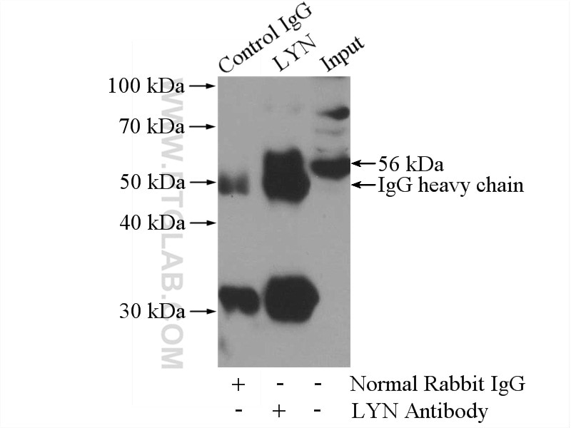 Immunoprecipitation (IP) experiment of HeLa cells using LYN Polyclonal antibody (18135-1-AP)