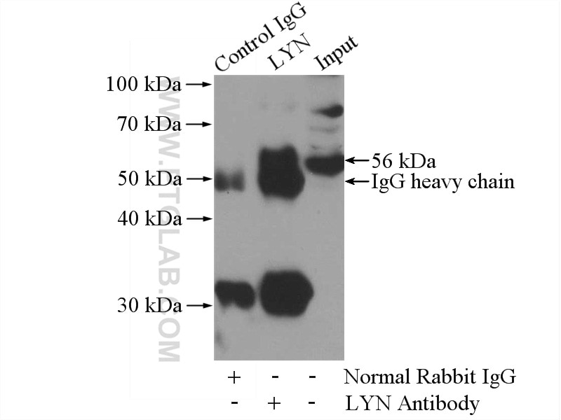 IP experiment of HeLa using 18135-1-AP