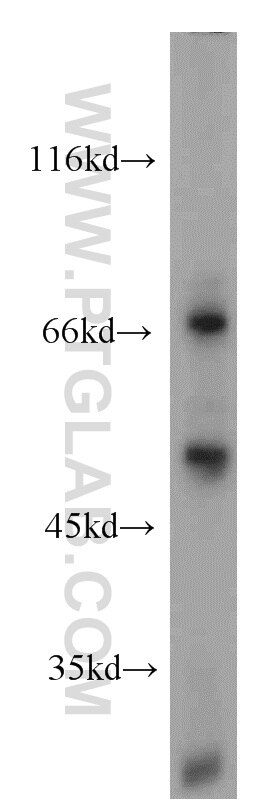 Western Blot (WB) analysis of HL-60 cells using LYN Polyclonal antibody (18135-1-AP)