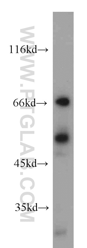 Western Blot (WB) analysis of Jurkat cells using LYN Polyclonal antibody (18135-1-AP)