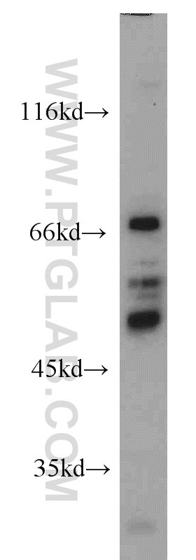 Western Blot (WB) analysis of K-562 cells using LYN Polyclonal antibody (18135-1-AP)