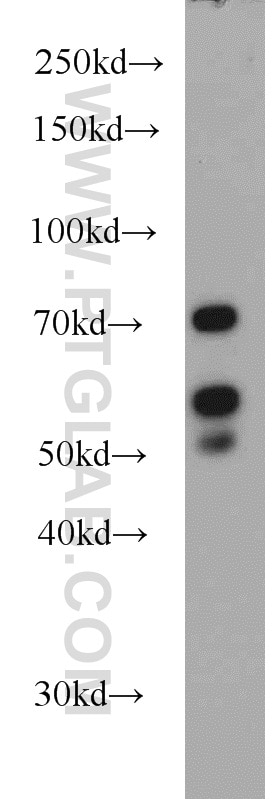 Western Blot (WB) analysis of HeLa cells using LYN Polyclonal antibody (18135-1-AP)