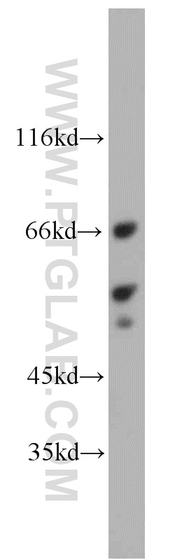 Western Blot (WB) analysis of L02 cells using LYN Polyclonal antibody (18135-1-AP)