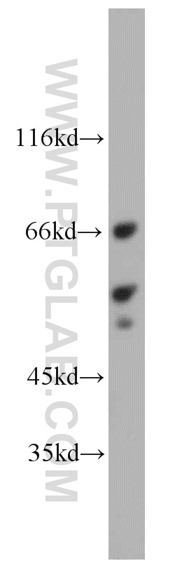 WB analysis of L02 using 18135-1-AP