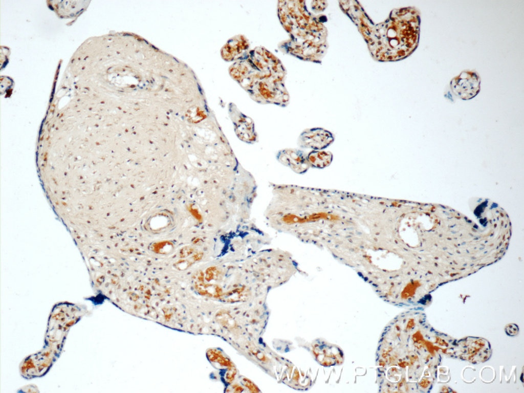 Immunohistochemistry (IHC) staining of human placenta tissue using LYN Monoclonal antibody (60211-1-Ig)