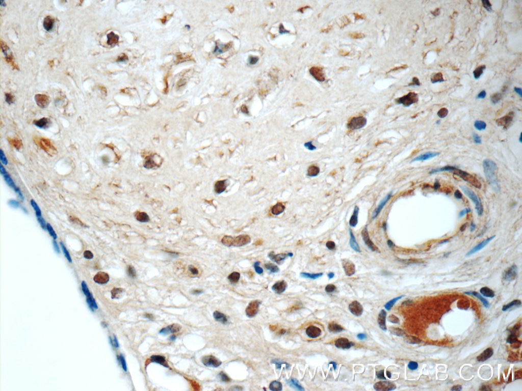 Immunohistochemistry (IHC) staining of human placenta tissue using LYN Monoclonal antibody (60211-1-Ig)