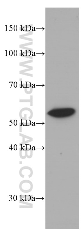 Western Blot (WB) analysis of HeLa cells using LYN Monoclonal antibody (60211-1-Ig)
