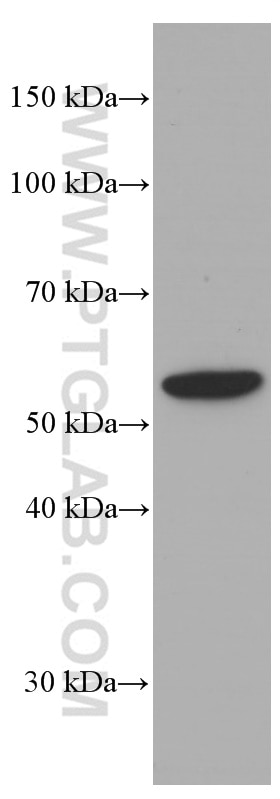 Western Blot (WB) analysis of Jurkat cells using LYN Monoclonal antibody (60211-1-Ig)