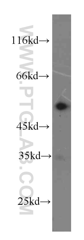 Western Blot (WB) analysis of Jurkat cells using LYN Monoclonal antibody (60211-1-Ig)