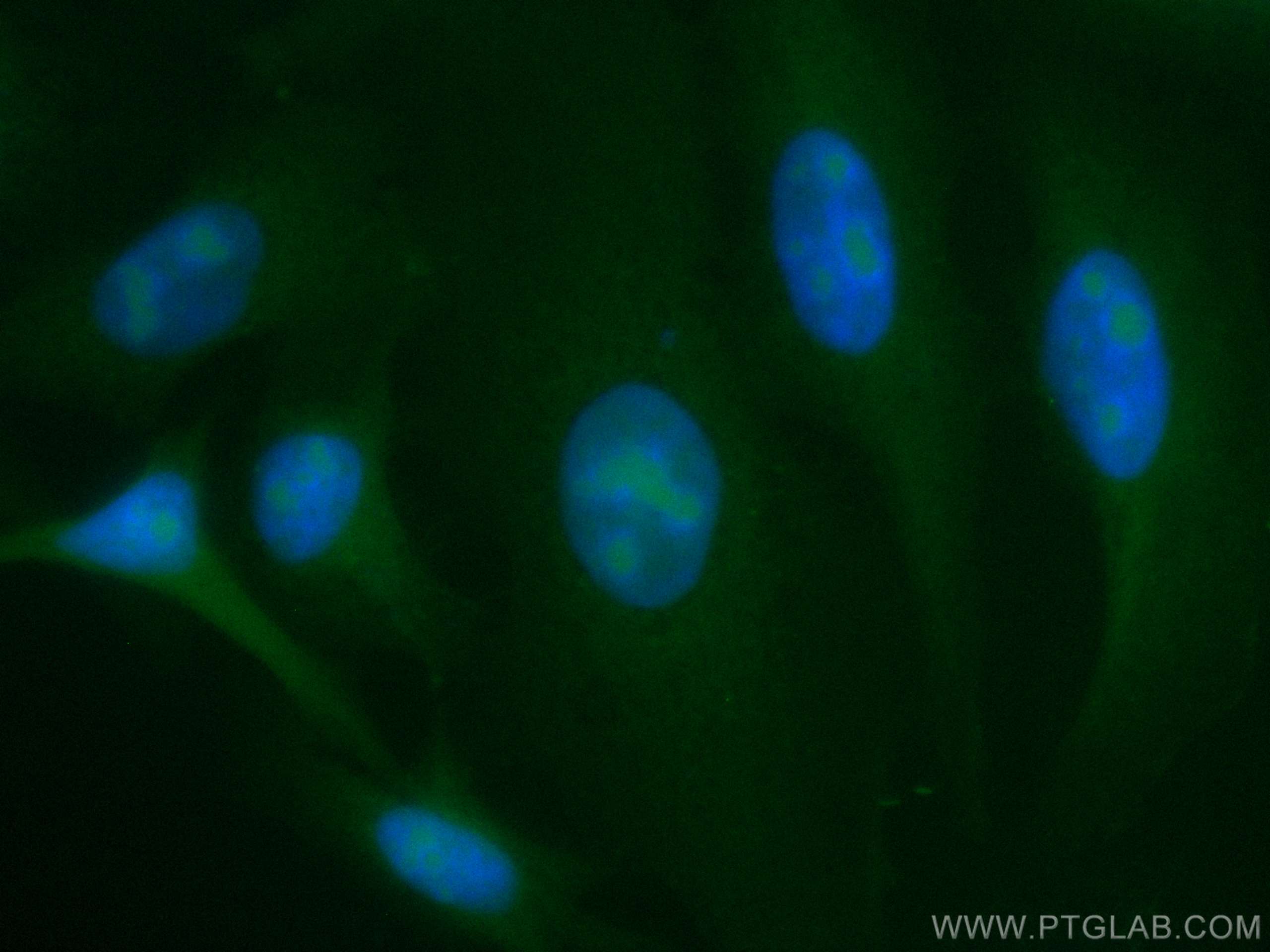 Immunofluorescence (IF) / fluorescent staining of HepG2 cells using CoraLite® Plus 488-conjugated LYN Monoclonal antib (CL488-60211)