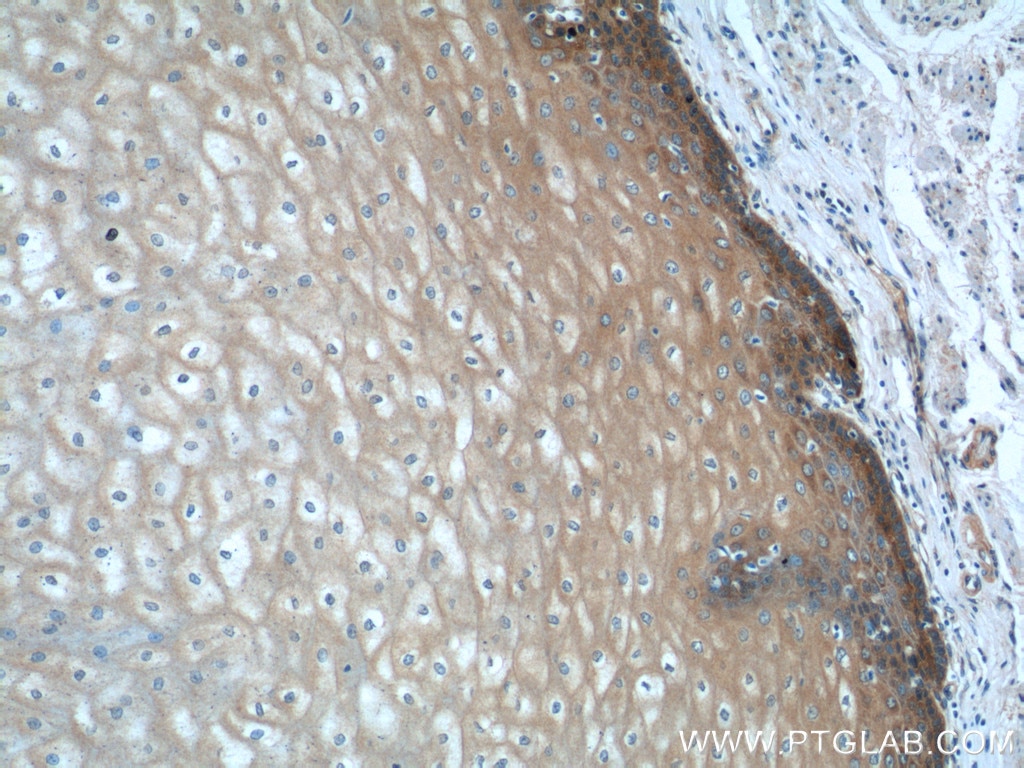 Immunohistochemistry (IHC) staining of human oesophagus tissue using LYNX1 Polyclonal antibody (13373-1-AP)