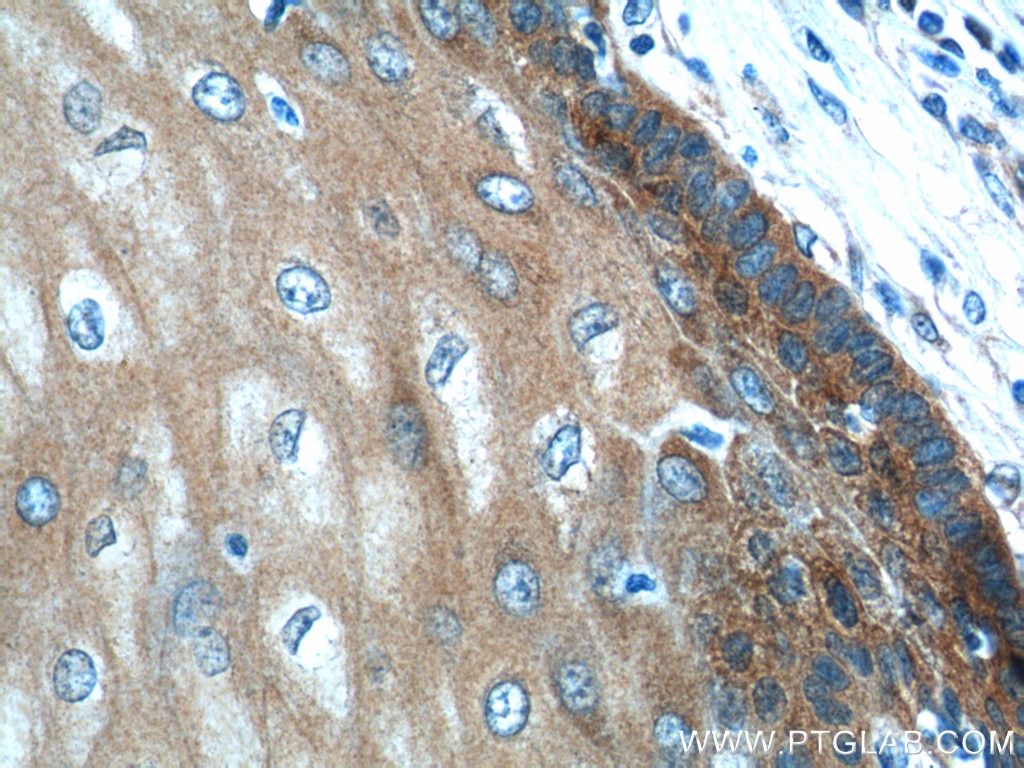 Immunohistochemistry (IHC) staining of human oesophagus tissue using LYNX1 Polyclonal antibody (13373-1-AP)