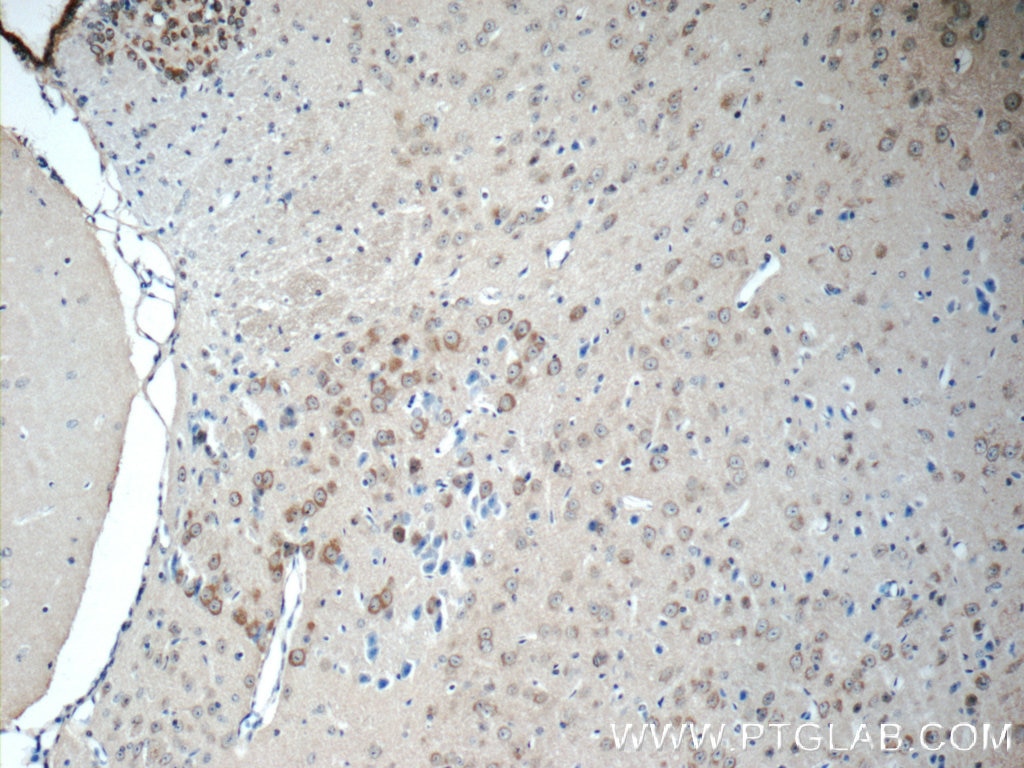 Immunohistochemistry (IHC) staining of mouse brain tissue using LYNX1 Polyclonal antibody (13373-1-AP)
