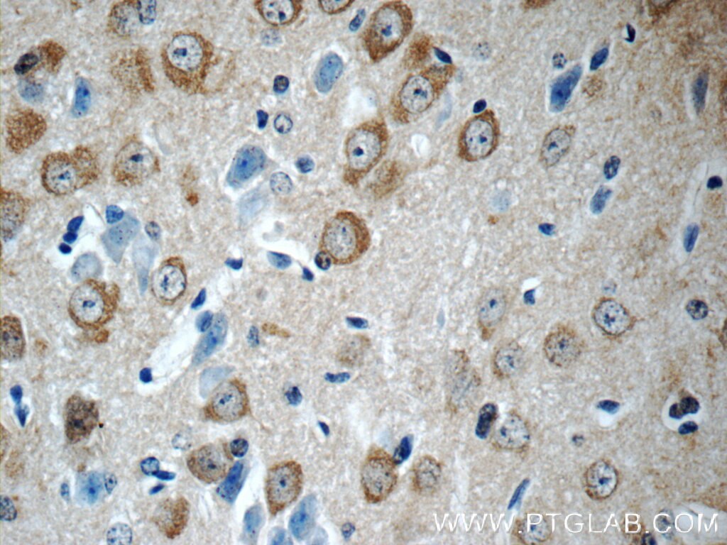 Immunohistochemistry (IHC) staining of mouse brain tissue using LYNX1 Polyclonal antibody (13373-1-AP)