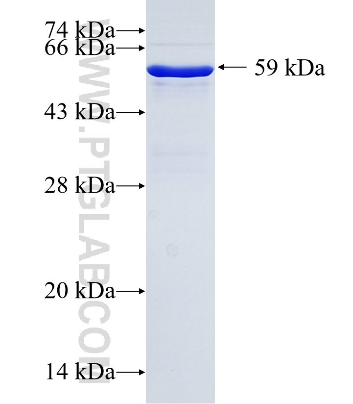 LYPD3 fusion protein Ag34961 SDS-PAGE