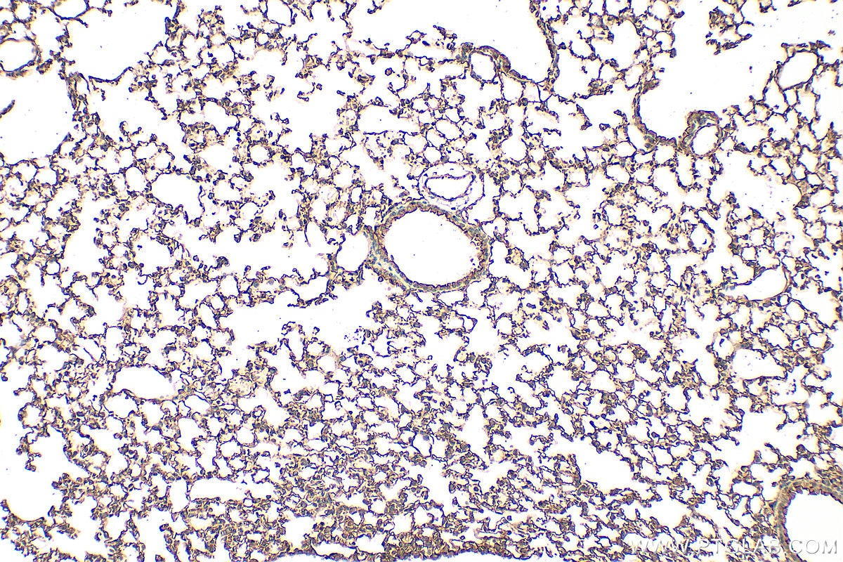 IHC staining of mouse lung using 25508-1-AP (same clone as 25508-1-PBS) Immunohistochemistry (IHC) staining of mouse lung tissue using LYPD6B Polyclonal antibody (25508-1-AP)