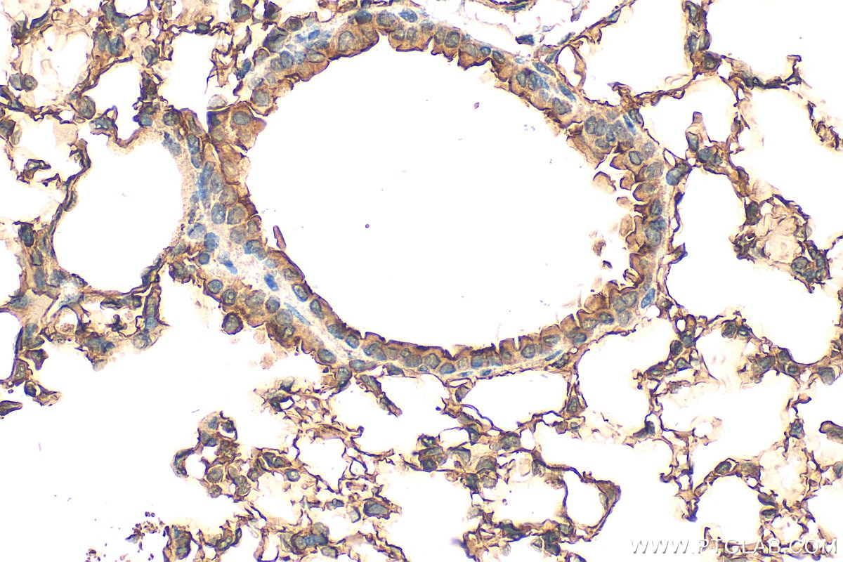 IHC staining of mouse lung using 25508-1-AP (same clone as 25508-1-PBS) Immunohistochemistry (IHC) staining of mouse lung tissue using LYPD6B Polyclonal antibody (25508-1-AP)