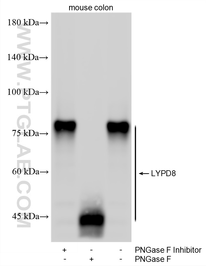Western Blot (WB) analysis of various lysates using LYPD8 Recombinant monoclonal antibody (87446-1-RR)