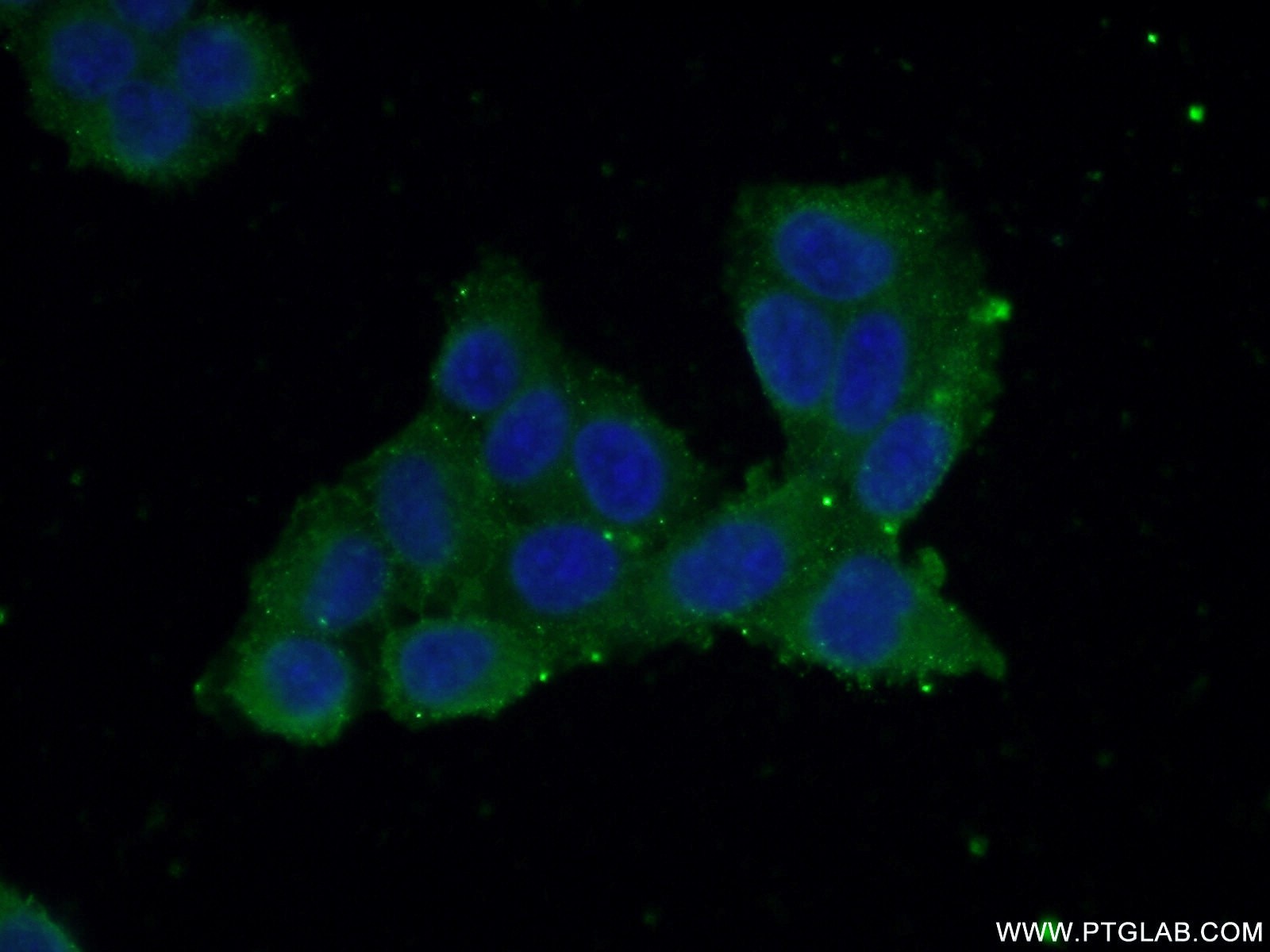 Immunofluorescence (IF) / fluorescent staining of HeLa cells using LYPLA1 Polyclonal antibody (16055-1-AP)
